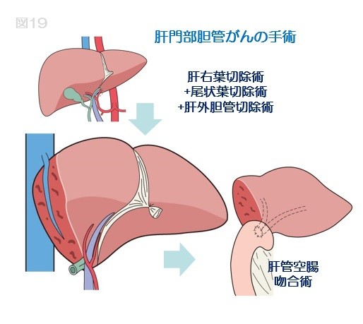 肝胆膵センター｜診療科・部門｜白十字病院｜社会医療法人財団白