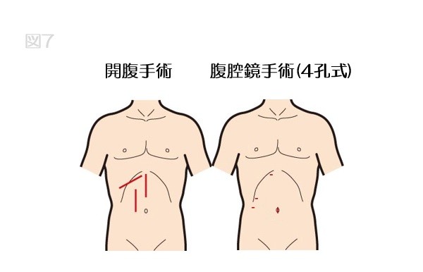 肝胆膵センター｜診療科・部門｜白十字病院｜社会医療法人財団白