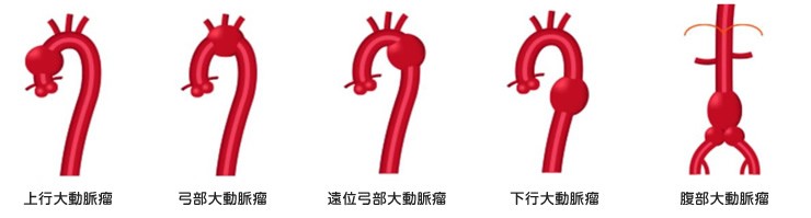心臓血管外科｜診療科・部門｜白十字病院｜社会医療法人財団白十字会