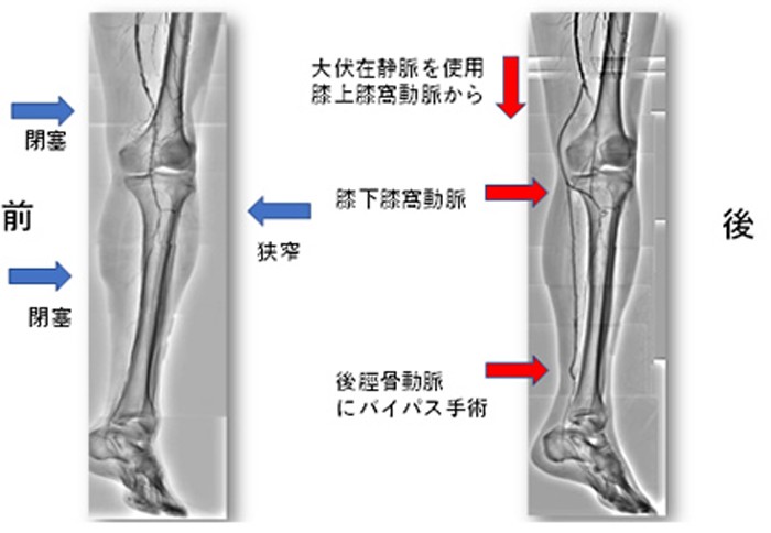 心臓血管外科｜診療科・部門｜白十字病院｜社会医療法人財団白十字会