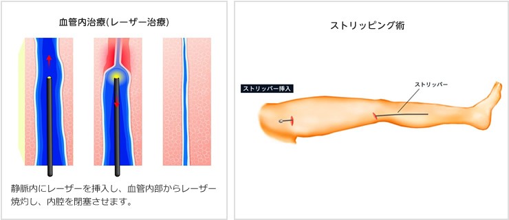 心臓血管外科手術の落とし穴 | 德永滋彦 |本 | 通販 | Amazon